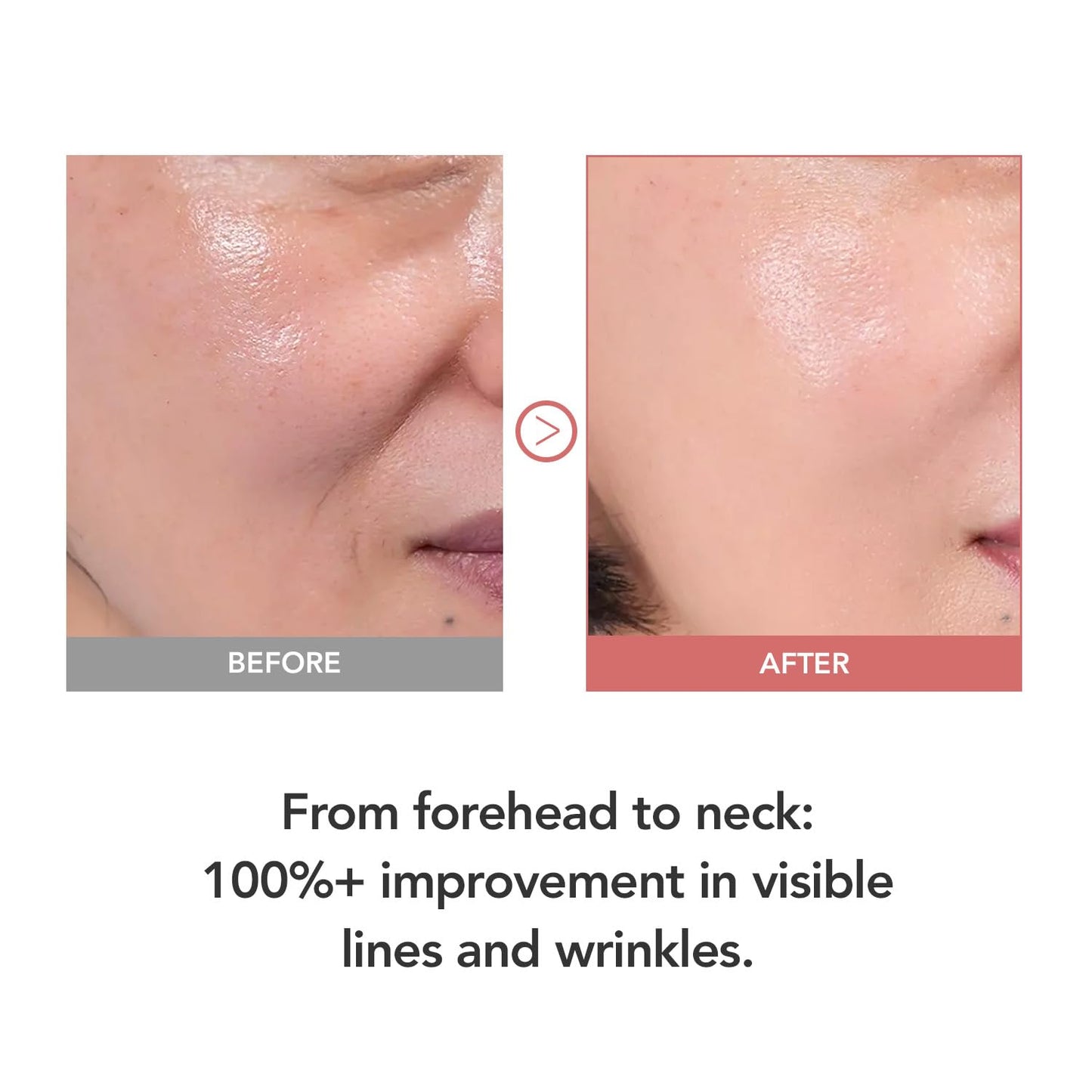 107% Crow’s Feet Improvement, 117% on Neck Lines & 109% on Nasolabial Lines – Boosts Elasticity – With Botulinum-Inspired Peptide and Collagen – Korean Skincare Korea’s Best Skincare Stick Kioskin