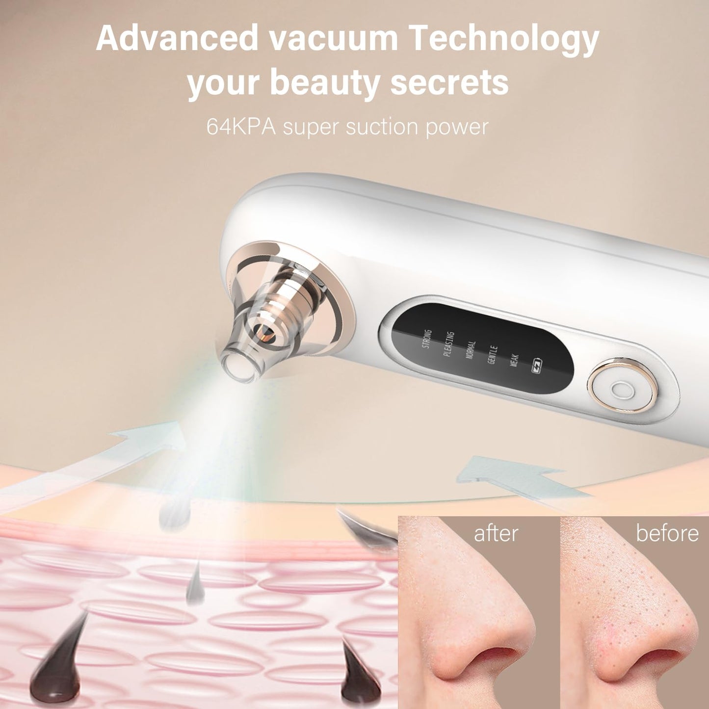 Blackhead Remover Pore Vacuum Kit for Face, 5 Adjustable Suction Levels Blackhead Extraction Tool, Face Suction Pore Cleaner with 4 Suction Heads, 4 Probes for Women & Men (White)