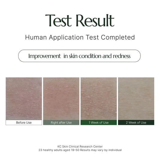 CHALLANS DE PARIS Crème d’Albarosa Excellence – Niacinamide Brightening Cream for Even Skin Tone | Dark Spot Care, Korean Skincare, 1.05 fl oz (30 ml) (ACNE CARE, 2.63 fl. oz)