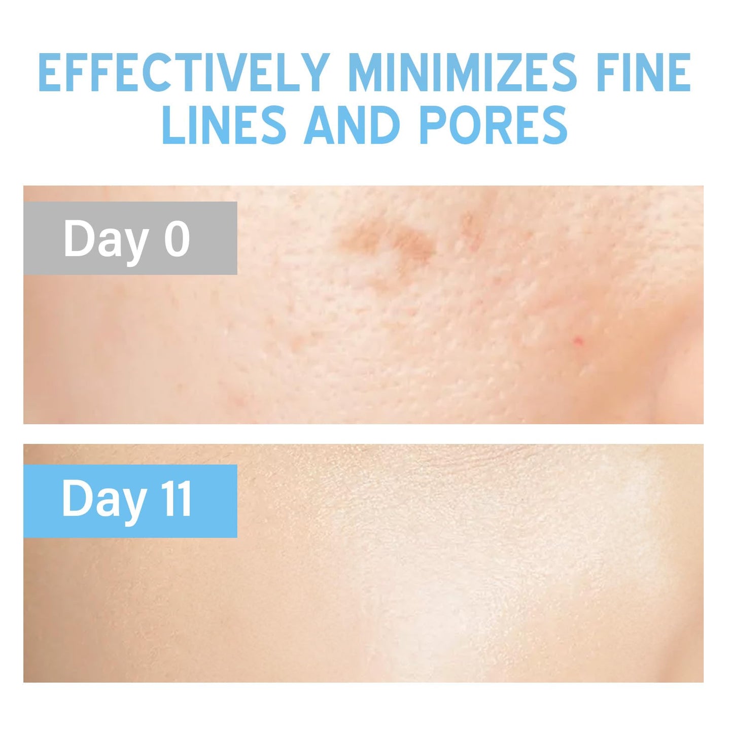 Josera Stem Cell Serum for Face, Microneedling Serum, Stem Cell Solution Ampoule to Use with and without Micro Needling, Anti Aging & Smooth Wrinkles, 2 Count