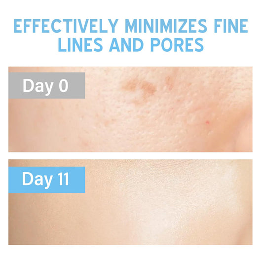 Josera Stem Cell Serum for Face, Microneedling Serum, Stem Cell Solution Ampoule to Use with and without Micro Needling, Anti Aging & Smooth Wrinkles, 2 Count