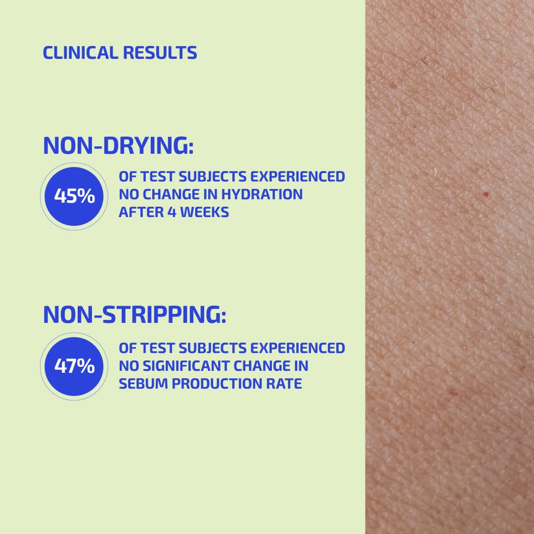 Codex Labs Eczema Soap for Kids & Adults – 2-Pack Unscented Eczema Hand Soap Bars with Shea Butter, Olive Oil & Calendula – Microbiome-Supporting, pH-Balanced, Clinically Tested – 8.4 oz Total