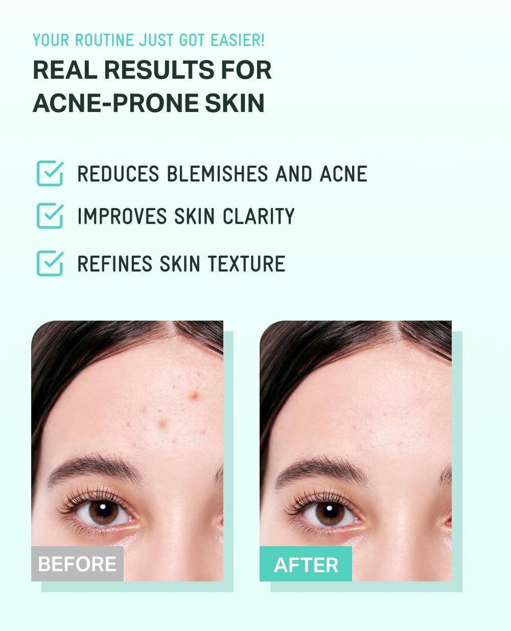 BRING GREEN Tea Tree Cica Soothing Cream Plus 100ml Korean Skin care, calming and soothing, moisturizer for skin, facial cream, trouble care, Blackhead Removing Pore care (Pack of 1)