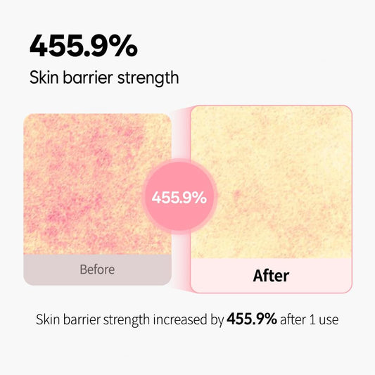 Candorlov Glowing Face Toner+Ampoule, Face Spray Hydrating Mist, Moisturization & Nourishment for Sensitive Dry Skin, Panthenol, Dragon Blood, Korean Skin Care, K Beauty(1.70 fl.oz)