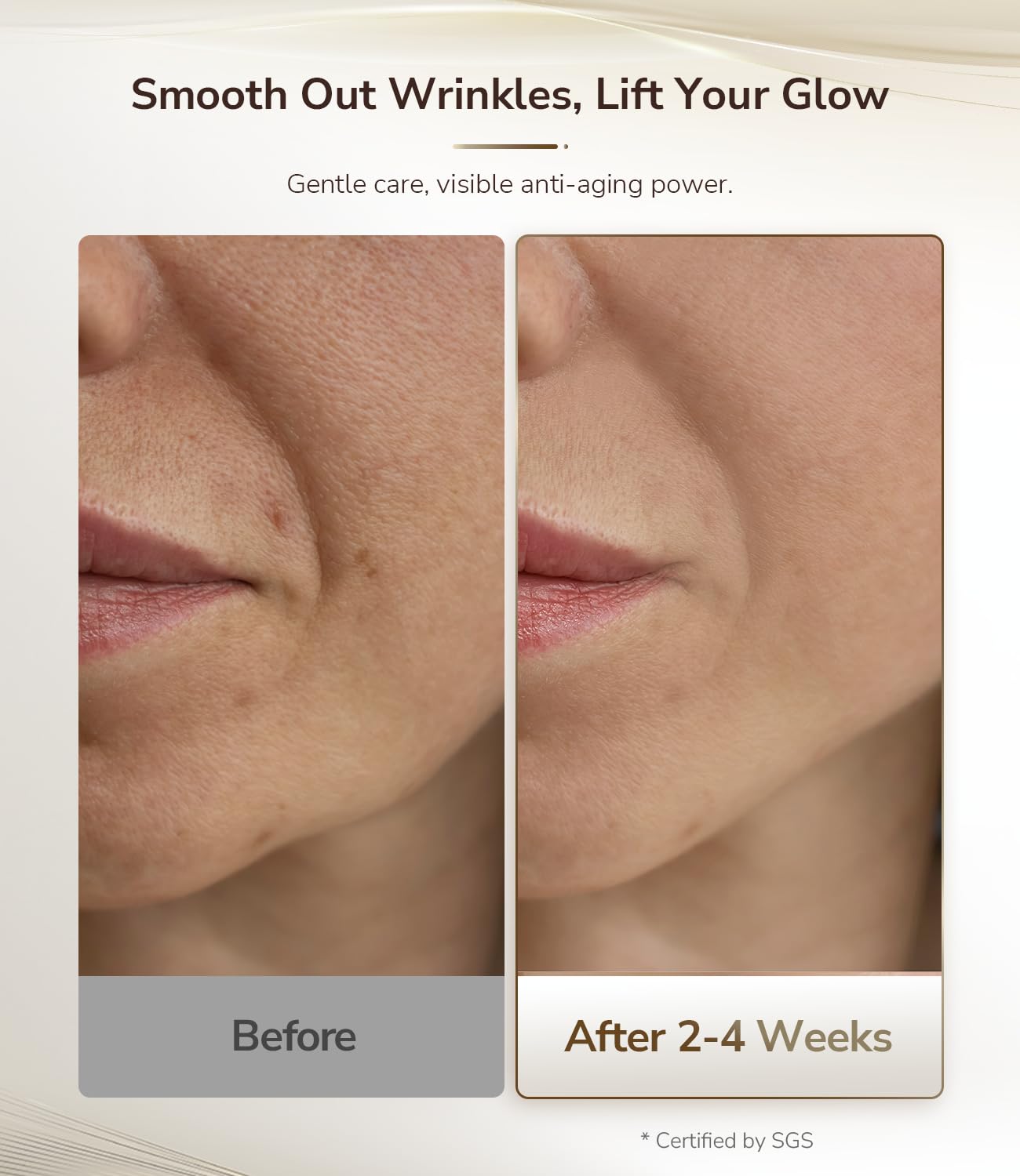 JOVS 4D Laser Therapy Mask for Face, LED Red Light Therapy Face Mask with 4 Wavelengths for Deep Anti-Aging, Precision Anti-Wrinkle, Skin Firming & Radiant Glow, 6x More Powerful Than LED