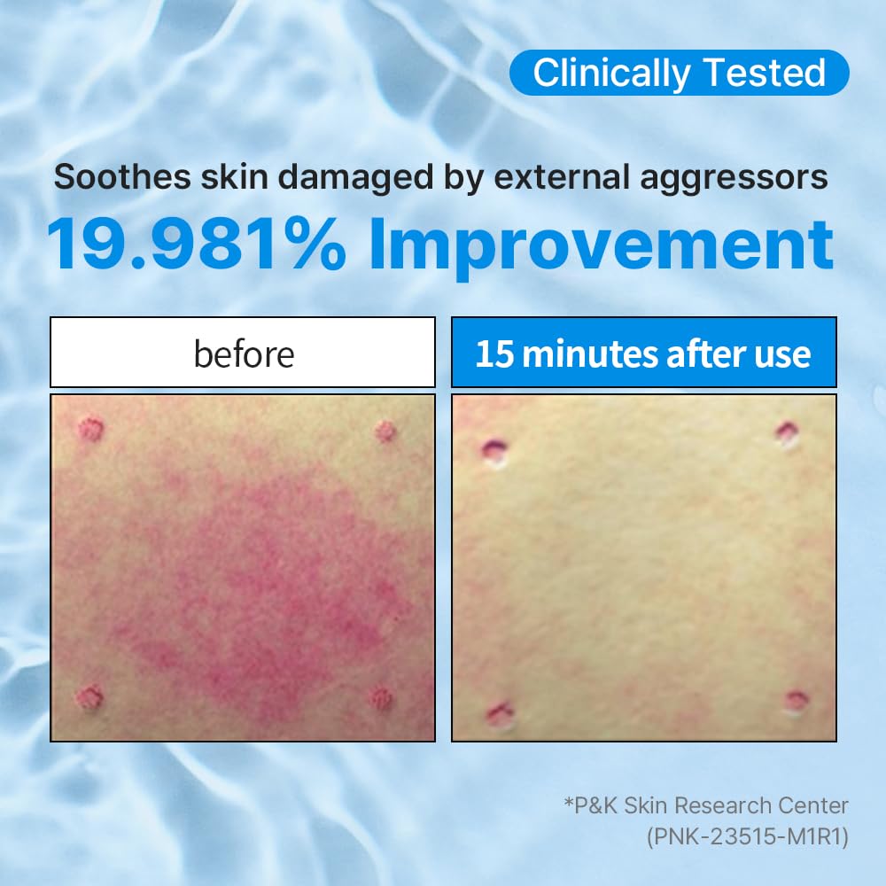 HA-CERA Moisture Ampoule, 6.42 fl oz, Calming Deep Moisturizing Serum with CICA Ceramide Hydrolyzed Hyaluronic Acid