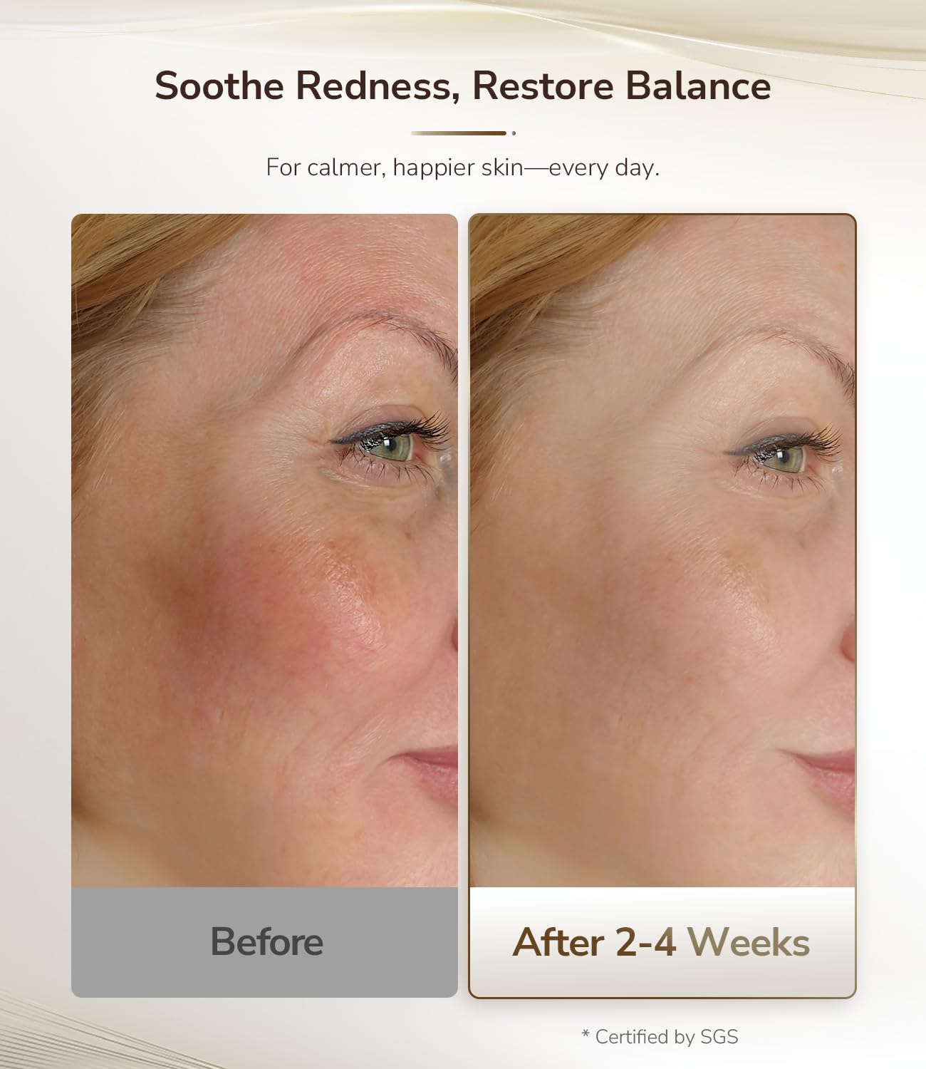 JOVS 4D Laser Therapy Mask for Face, LED Red Light Therapy Face Mask with 4 Wavelengths for Deep Anti-Aging, Precision Anti-Wrinkle, Skin Firming & Radiant Glow, 6x More Powerful Than LED