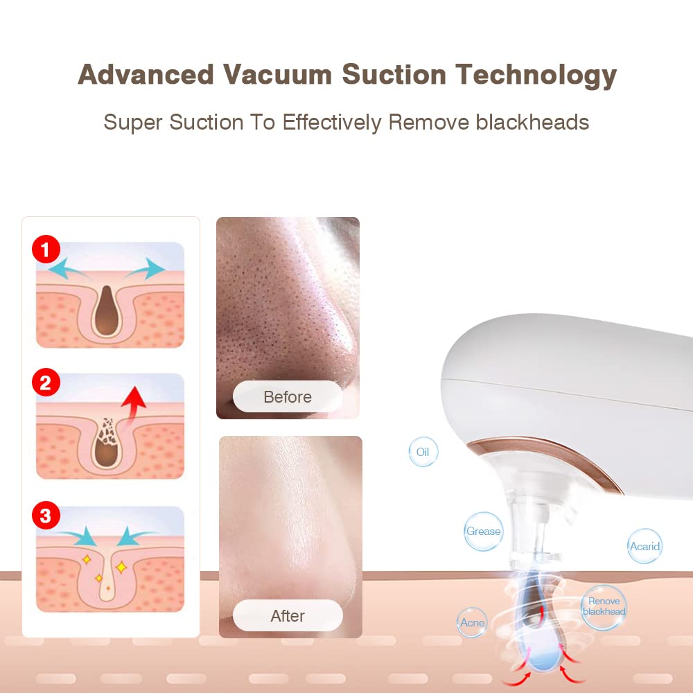 KinseiBeauty Electric Blackhead Remover Vacuum,Facial Suction Pore Cleanser, Acne Comedone Whitehead Blackhead Extractor Tool with 4 Removable Suction Heads,3 Suction Modes for Women and Men