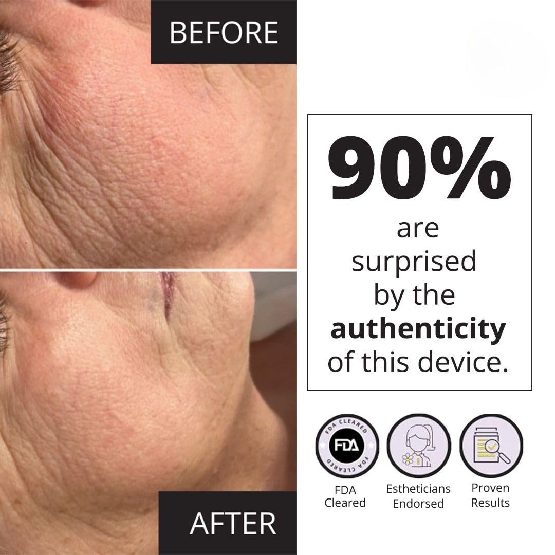 7E Wellness MyoLift Mini Microcurrent Facial Device - Non-Invasive Microcurrent Facial Device, Facial Skin Care Products for Anti Aging, Skin Tightening - Esthetician Supplies & Skin Care Tools -Face