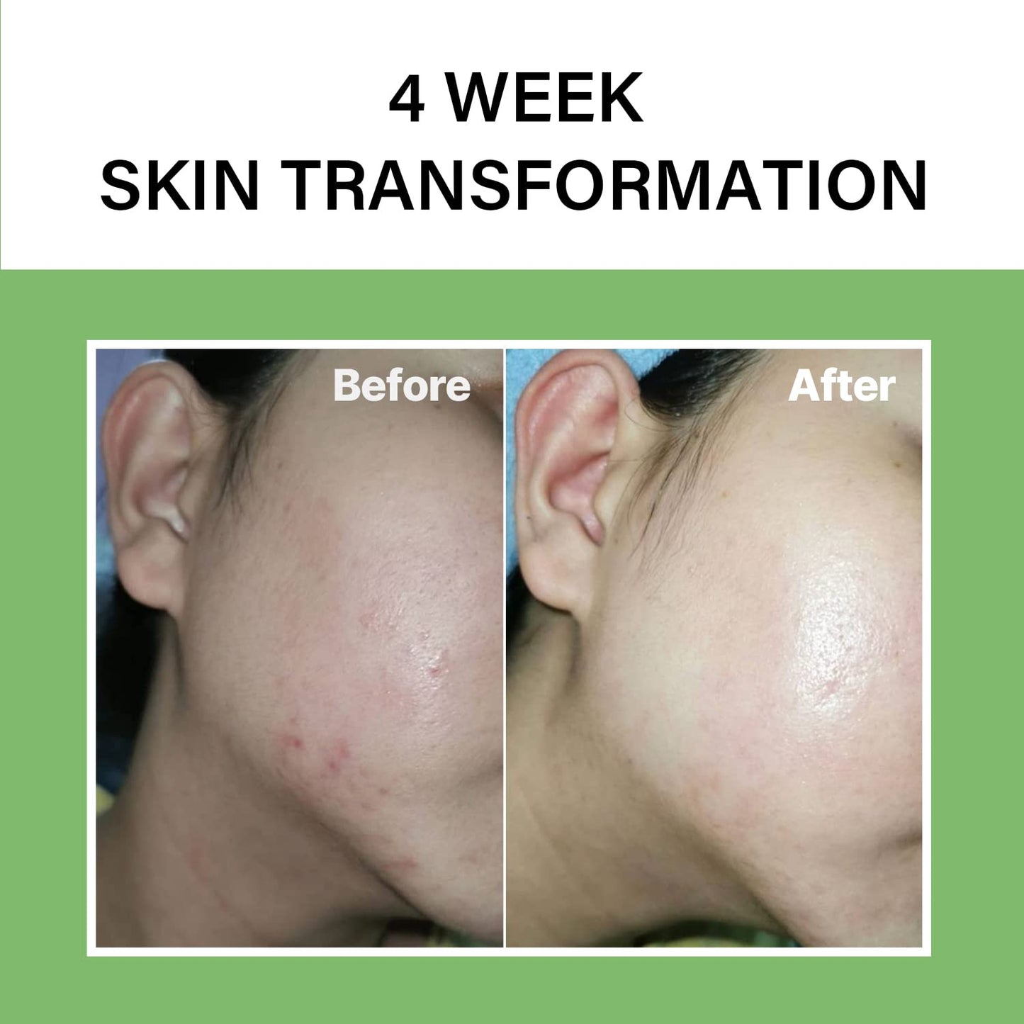 celimax Noni Energy Ampoule 30ml + The Real Noni Refresh Clay Mask 120g Bundle