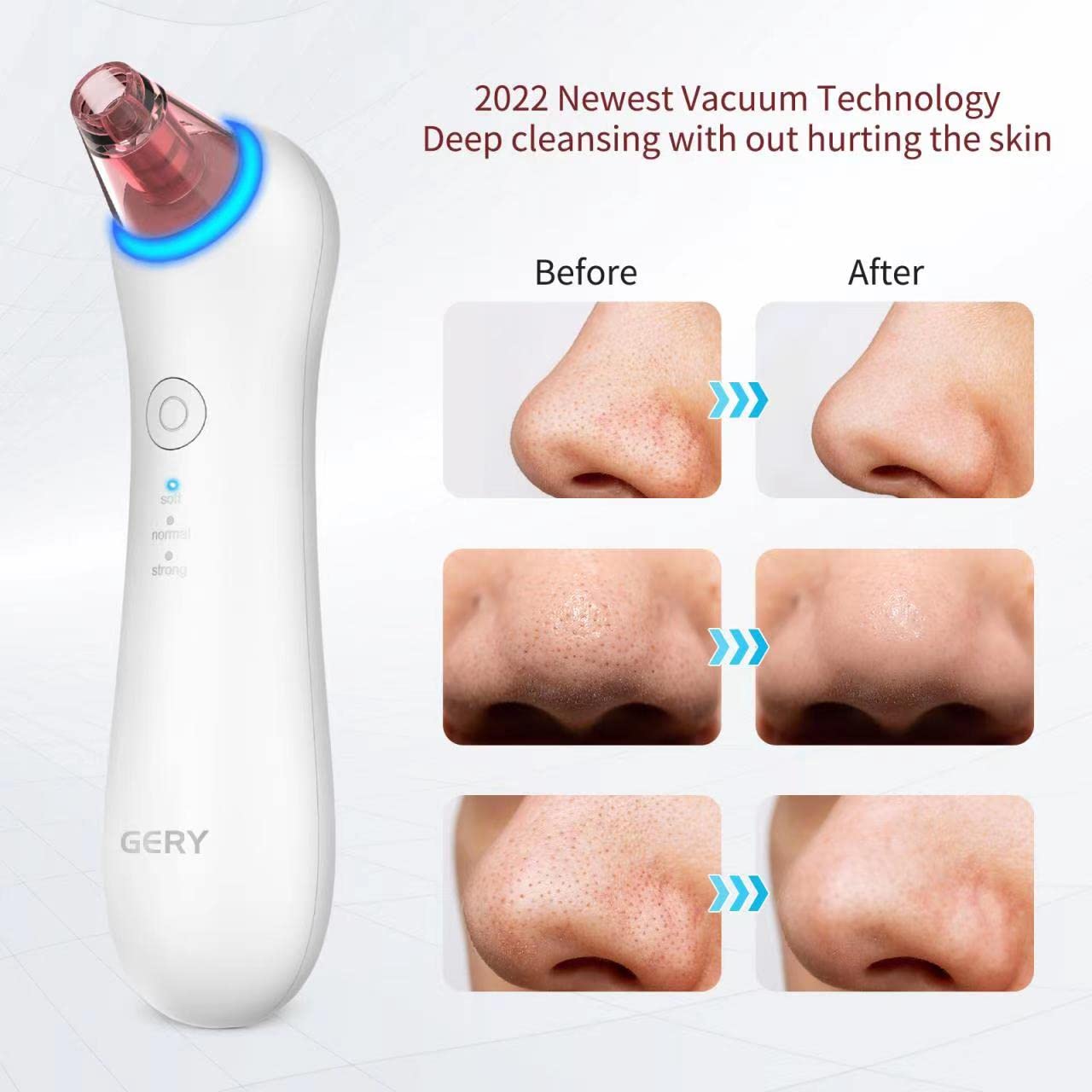 Blackhead Remover Pore Vacuum Extractor-Upgrade GERY Electric Comedone Acne Cleaner Kit Facial and Nose Peel Whitehead Removal Tool,Red Light Skin Rejuvenation & Blue Light Sterilization, and 4 Probes