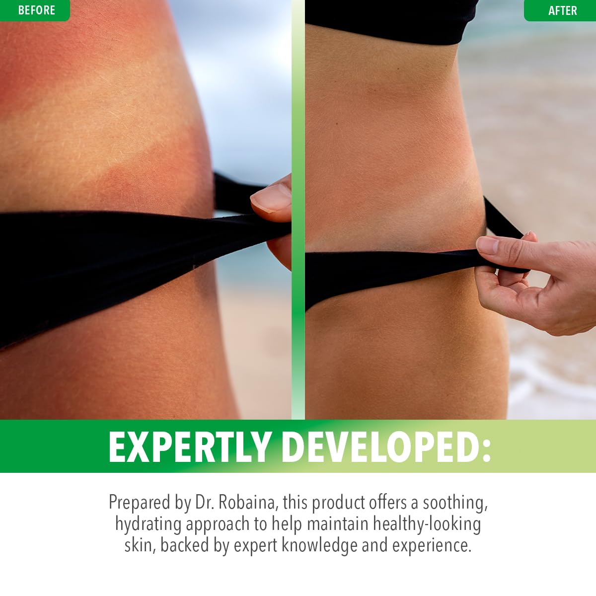 Dr. Robaina Natural Aloe Vera Gel with Emu Oil – Hydrating & Soothing Daily Skin Care for Dry Skin, Sun-Exposed Comfort & Irritation Relief – Non-Greasy, Quick-Absorbing – 12 oz | Made in USA