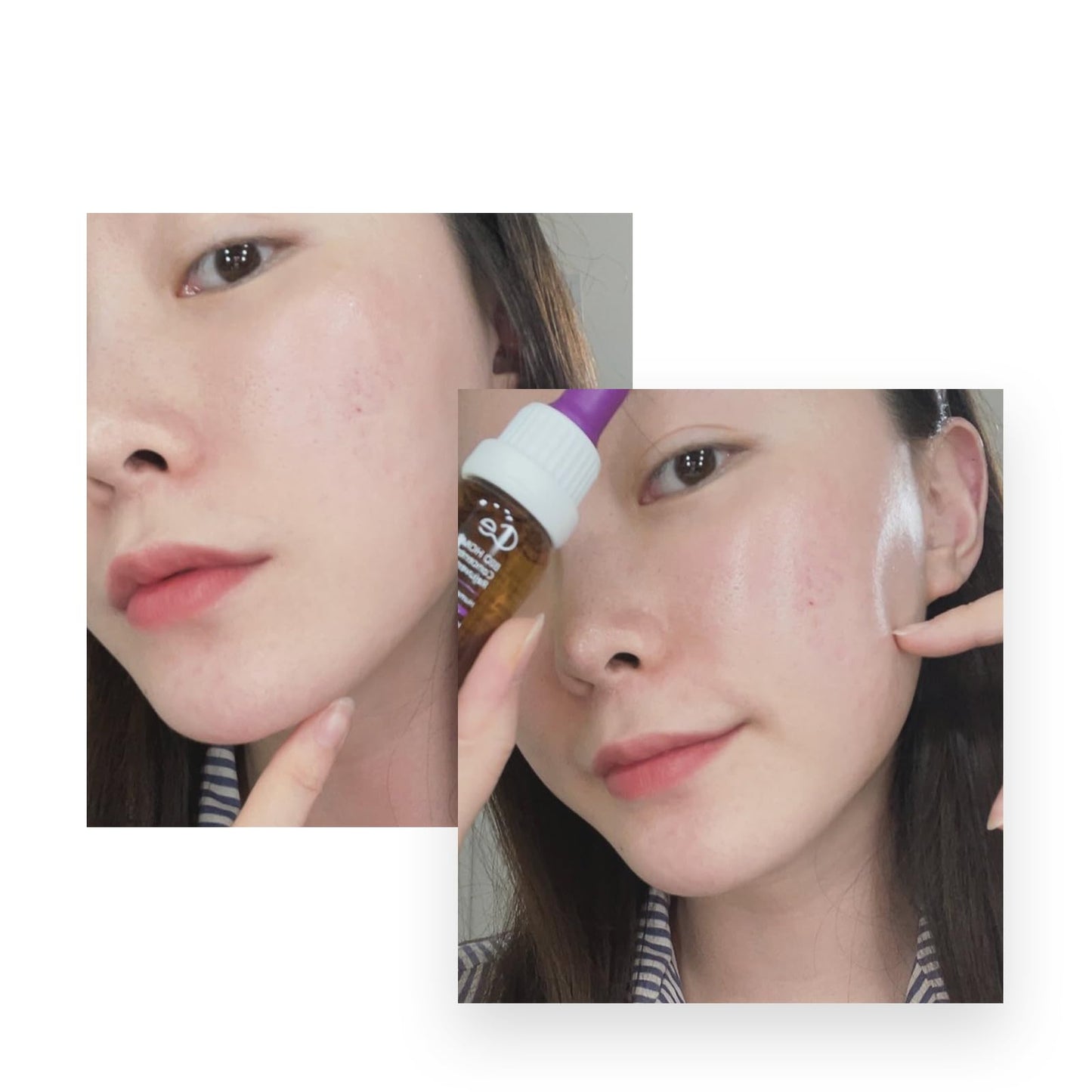 CELONIA Bio Home Solution Concentrated Skin Booster, Bio Stem Cell Ampoule, Korean Cell Growth Anti Aging Serum For Reduce Fine Line, Wrinkles & Acne Scars, Corrects Dark Spot & Reduce Redness (10ml)