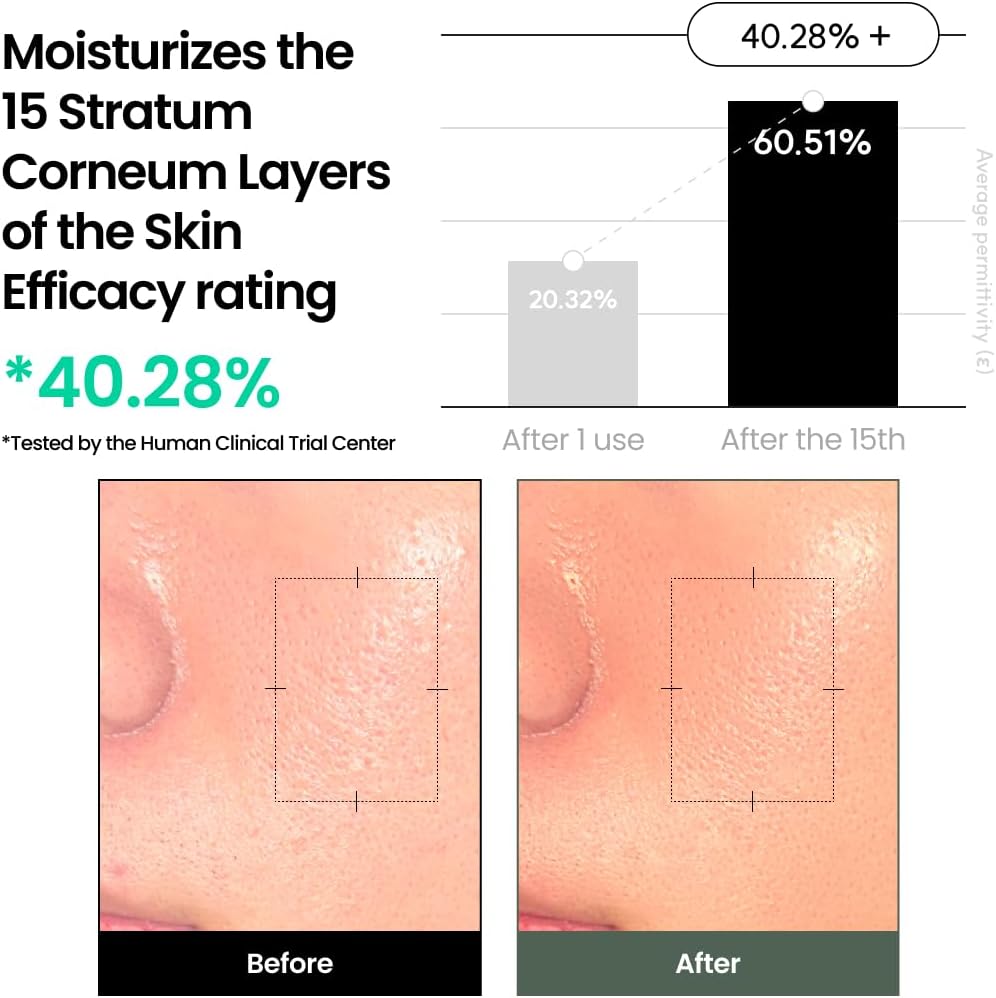 delphyr Liposome Waterful Bubble Serum, Hydrating Foaming Toner for Sensitive Skin with Centella Asiatica TECA, Korean Skincare for Trouble Care (5.07 fl. oz, 150ml)