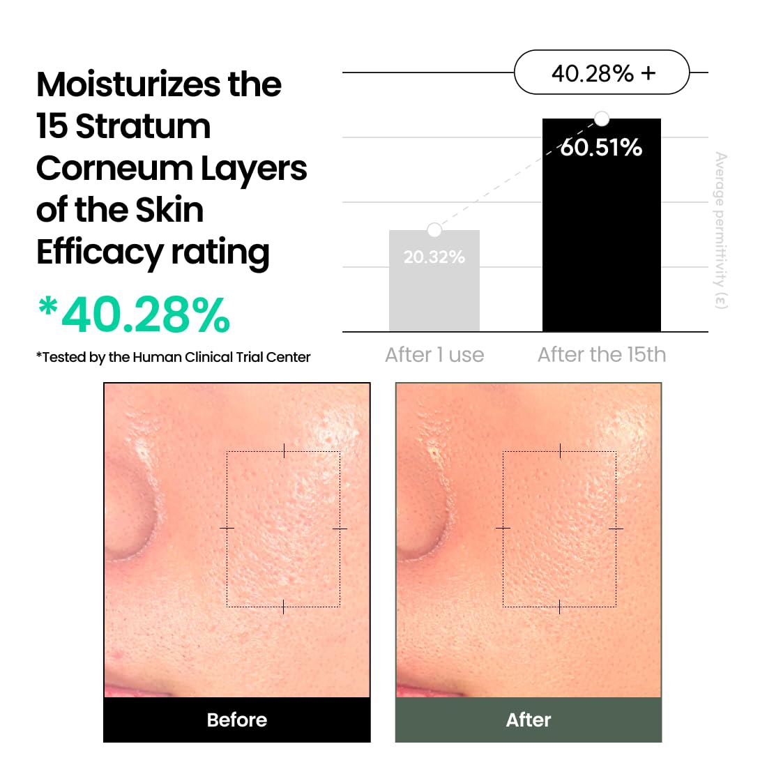 delphyr Liposome Waterful Bubble Serum, Hydrating Foaming Toner for Sensitive Skin with Centella Asiatica TECA, Korean Skincare for Trouble Care (5.07 fl. oz, 150ml)