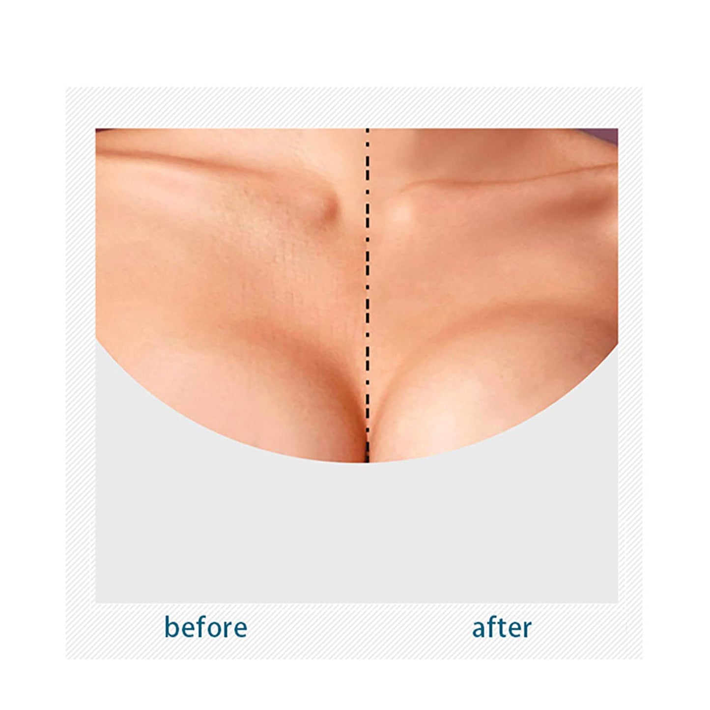 VolksRose Silicone Wrinkle Patches (18Pack) – Reusable Face, Forehead & Neck Patches for Wrinkles – Anti-Aging Overnight Mask Smooths Forehead Lines, Under Eyes, Mouth & Cleavage – Hydrating & Firming