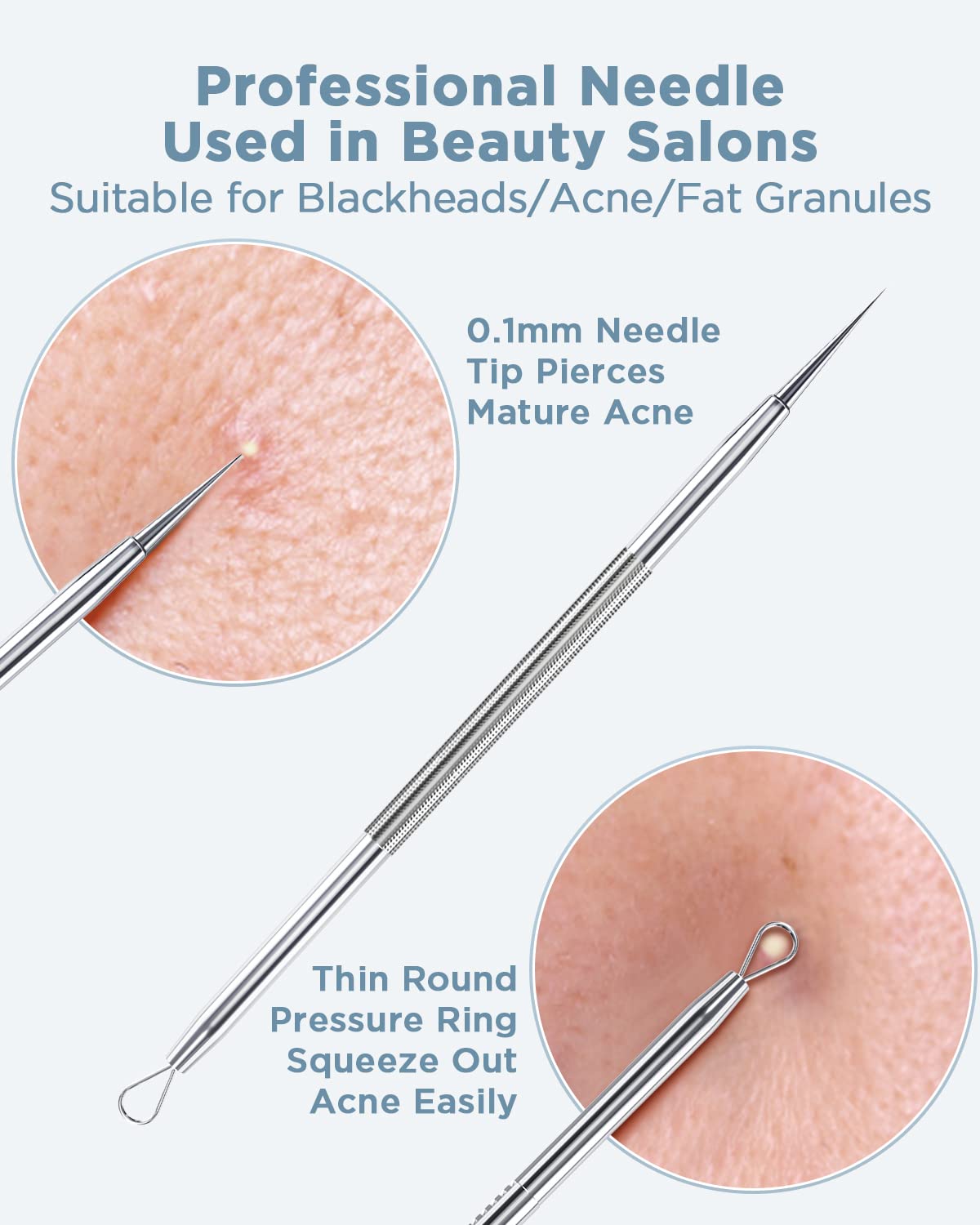 BESTOPE Blackhead Remover Blackhead Removal Pimple Comedone Extractor Tool - Treatment for Blemish Whitehead Popping Zit Removing with Metal Case (Silver)