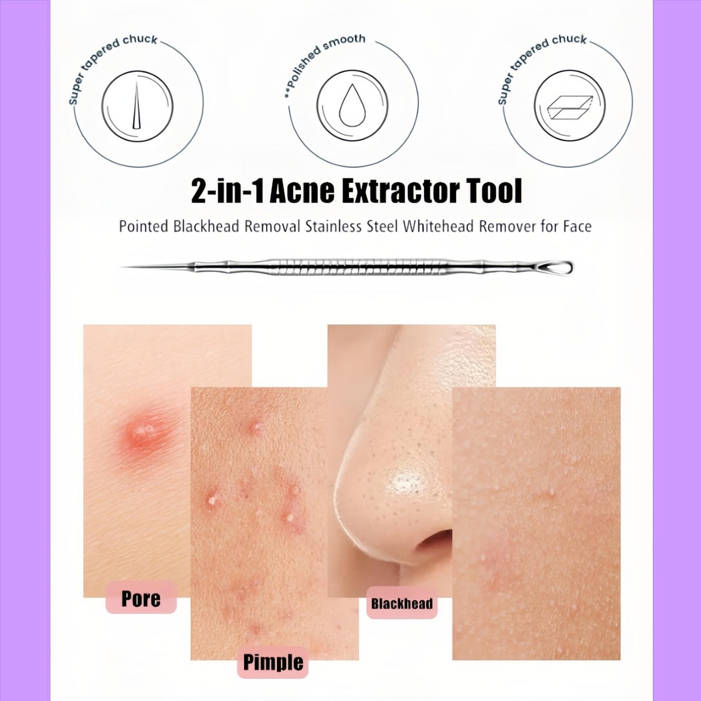 Blackhead Remover & Pimple Extractor Kit Dual-Ended Skin-Friendly Design for Sensitive Skin Professional Pore Cleanse & Acne Home Facial Care Tools with Stainless Steel Scraper (Purple-with Needle)