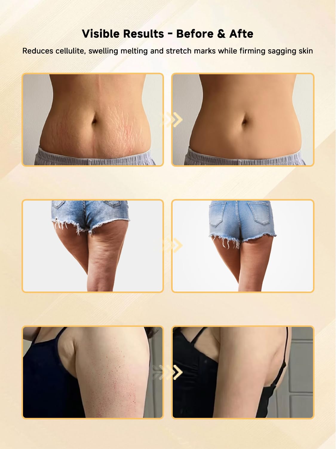 Body Sculpting Machine, Lymphatic Drainage Massager & Anti Cellulite Massage Tool, Helps Reduce Stretch Marks & Cellulite, Pain Relief Devices for Sciatica Nerve, Legs, Arms, Hip, Muscle & Lower Back