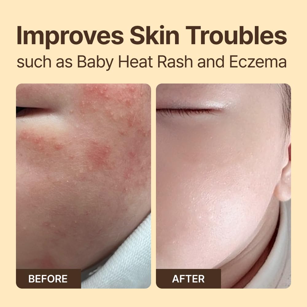 ruuve Ceramide Intense Moisture Cream – Deep Hydration Cream, Fragrance Free, Non-Greasy, Improves Moisture up to 2.5mm in One Use, Dermatologically Tested, Korean Skin care, 5.07 Fl oz