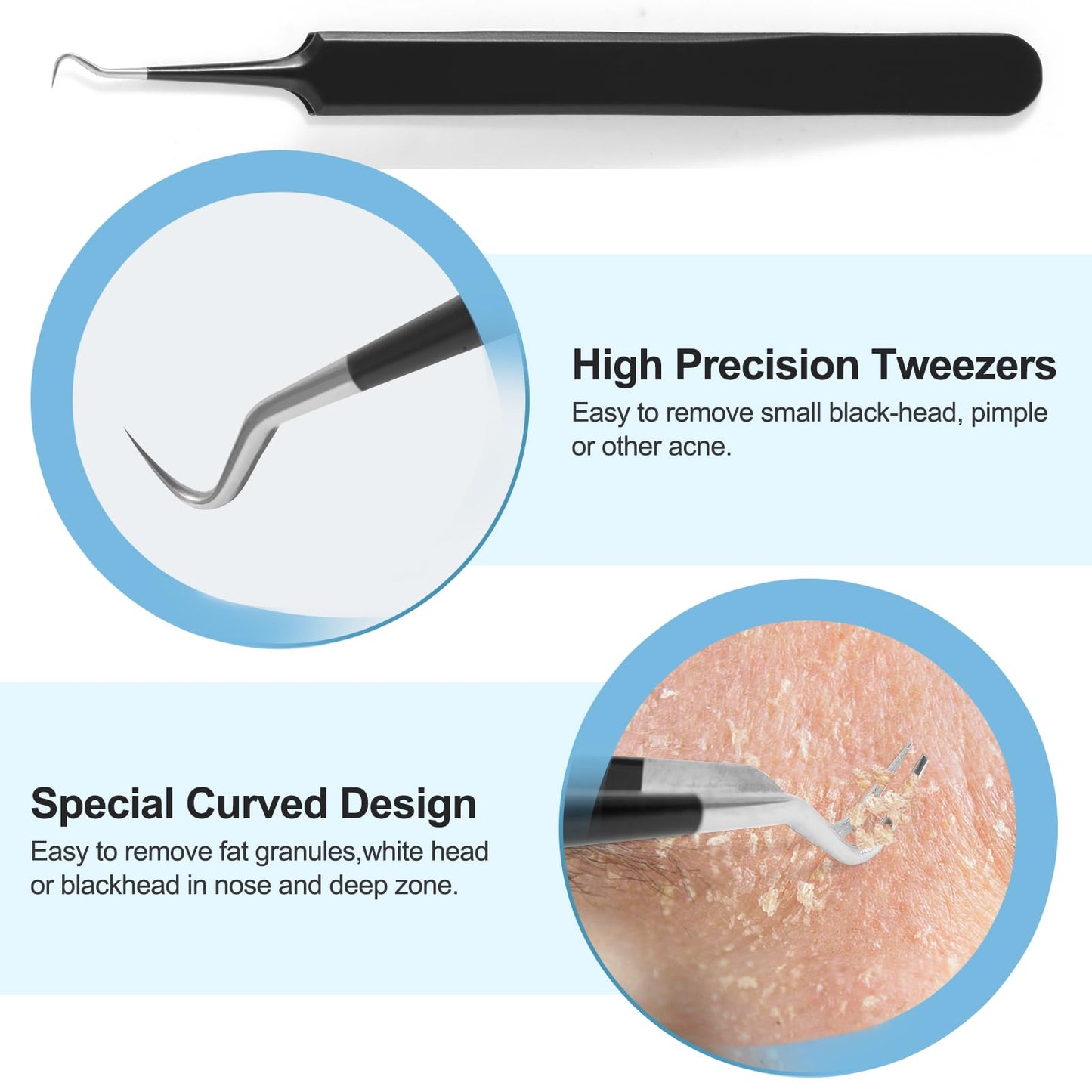 Blackhead Remover Tools Pimple Popper Tool Kit, Comedones Extractor Acne Removal Kit for Blemish, Black Head Remover for face Risk Free Treatment for Whitehead Popping
