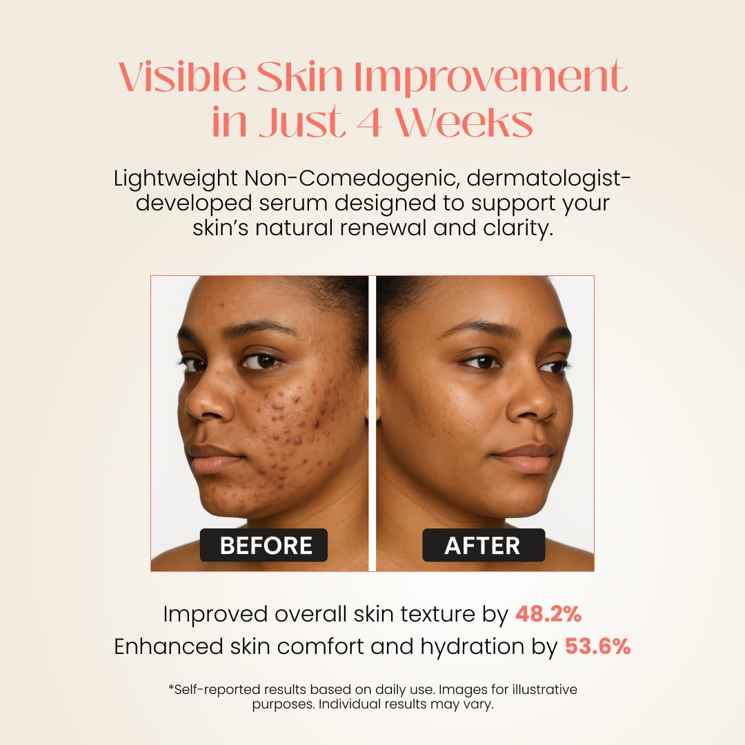 YOUZU Hypochlorous Acid Daily Refresh Serum – Lightweight Skin-Reviving Formula – Dermatologist-Formulated – Alcohol-Free, Fragrance-Free, Vegan – For Balanced, Radiant-Looking Skin