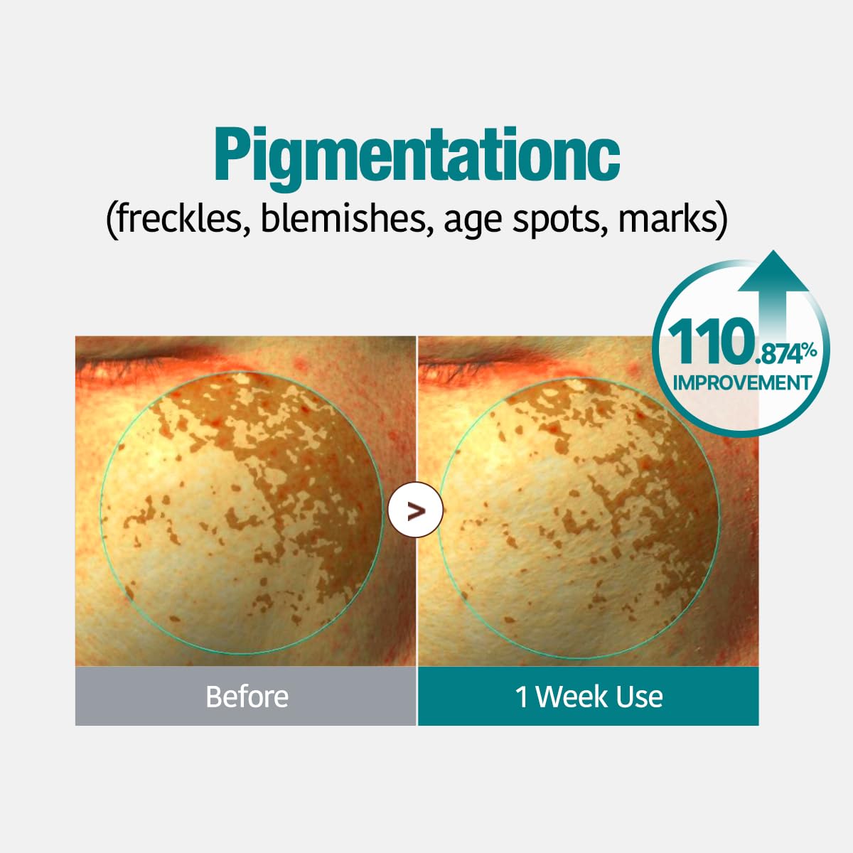 GOODAL Green Tangerine Vita C Gel Mask, Deep Moisturizing Hydrogel Essence, Vitamin C Face Mask for Glass & Glow Skin, Overnight Facial Mask, Jelly Mask for Sensitive Skin, Korean Skin Care, 5EA