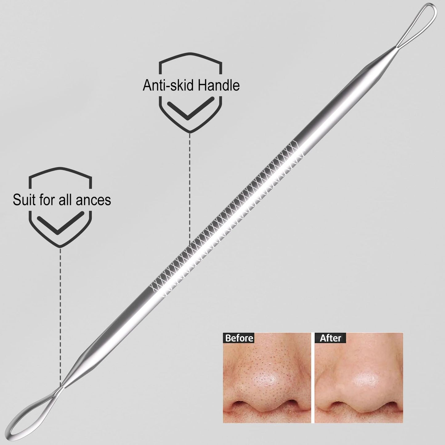 Cbiumpro 6 Pack Blackhead Remover Tools, Pimple Popper Tool Kit, Professional Blackhead Extractor for Zit, Acne, Whitehead, Comedone on Nose - with Case