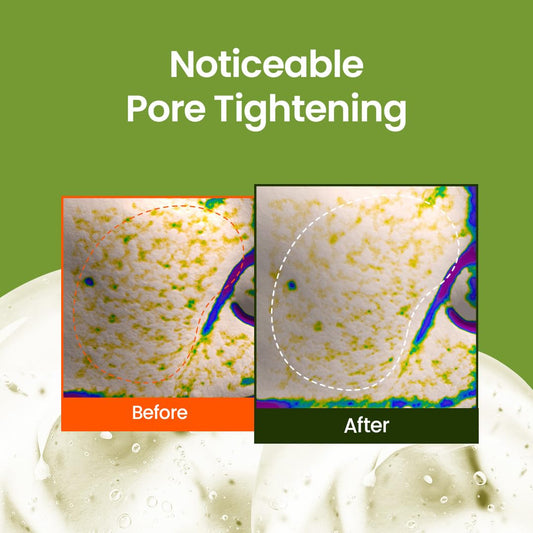 beplain Mung Bean Pore Tight -Up Serum | Niacinamide serum | Pore Minimizing | Redness Relief | Hydration | Korean Skincare, For All Skin Types (1.69 fl.oz/50ml)