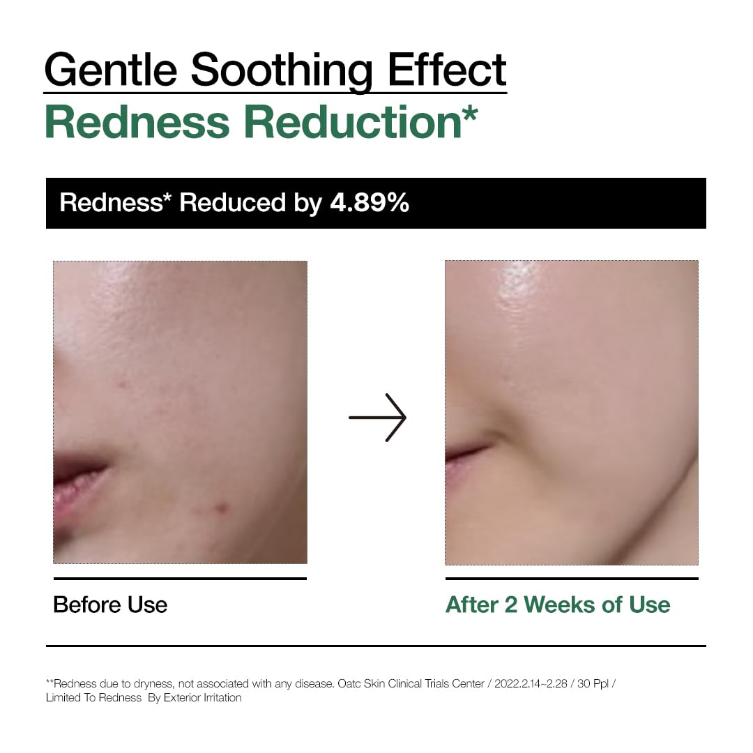 Anua Heartleaf 80 Soothing Ampoule, Hydration Facial Serum for Glass Skin, Panthenol, Hyaluronic Acid, Non-Greasy, Gentle Formula, Lightweight Essence, Vegan, Korean Skin Care, 30ml/1.01 fl.oz