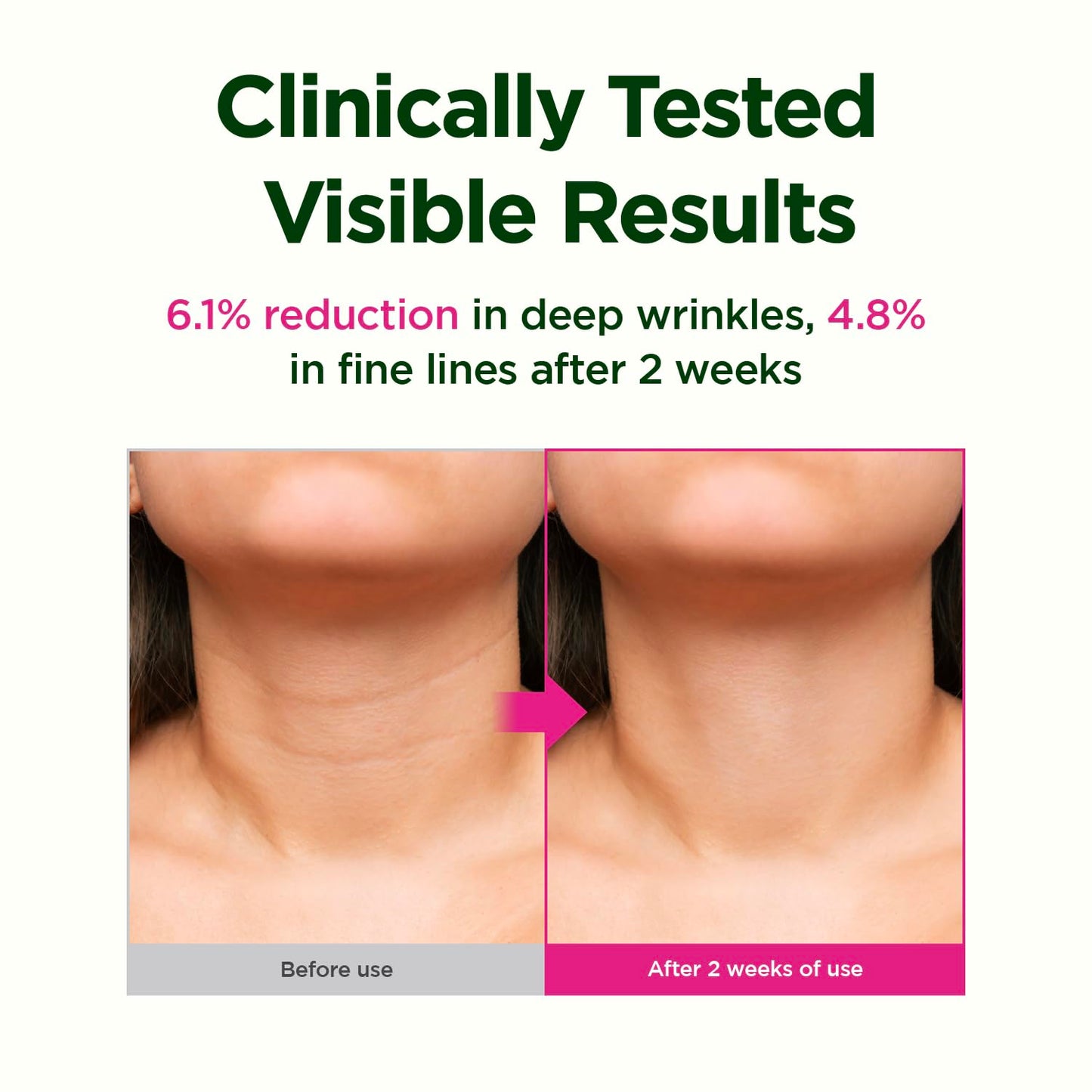 CKD Retino Collagen Gua Sha Neck Cream - Firming Cream for Neck and Jawline Tightening, Lifting, and Wrinkle Reduction with Stainless Steel Roller. Korean Skin Care,1.69 fl oz.