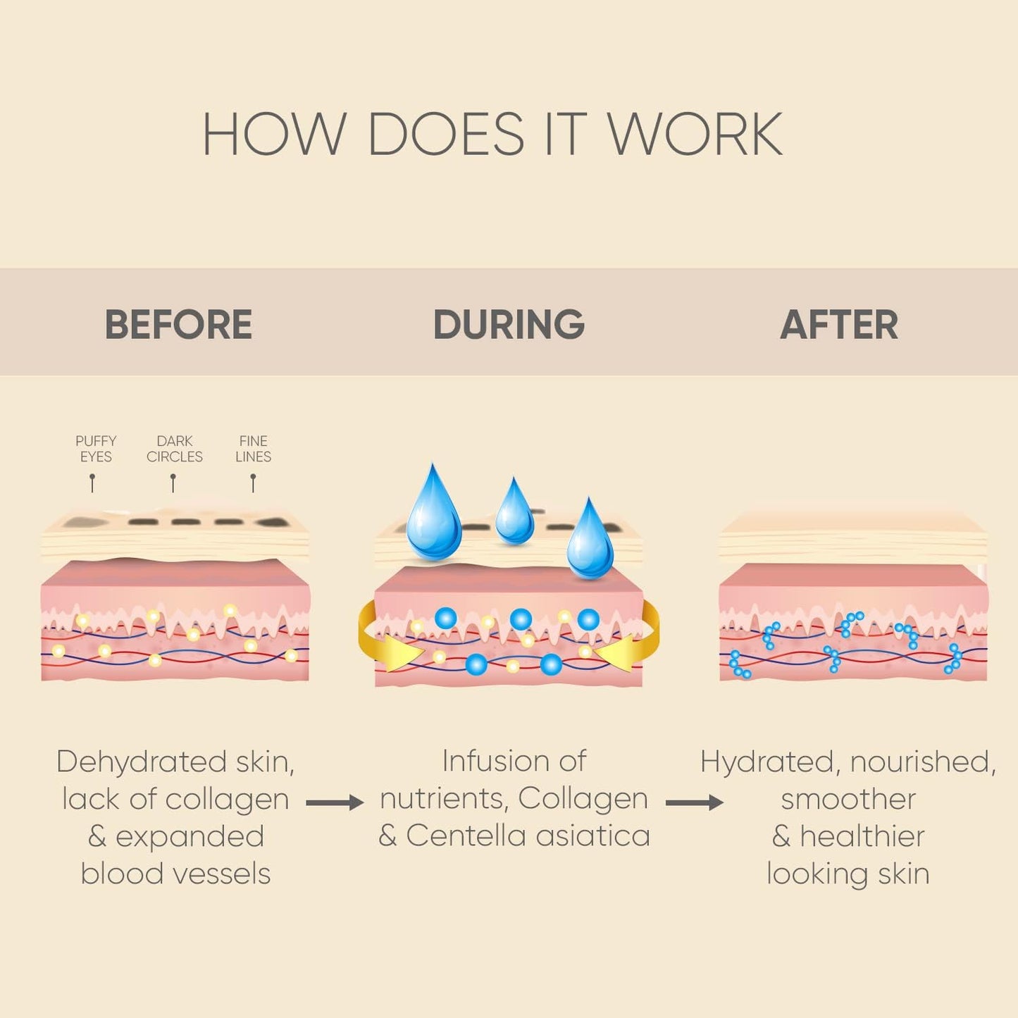 Under Eye Patches (20 Pairs) - Eye Patches For Puffy Eyes And Dark Circles - Under Eye Mask For Beauty & Personal Care - Under Eye Mask Amino Acid & Collagen For Dark Circles And Puffiness by Celor