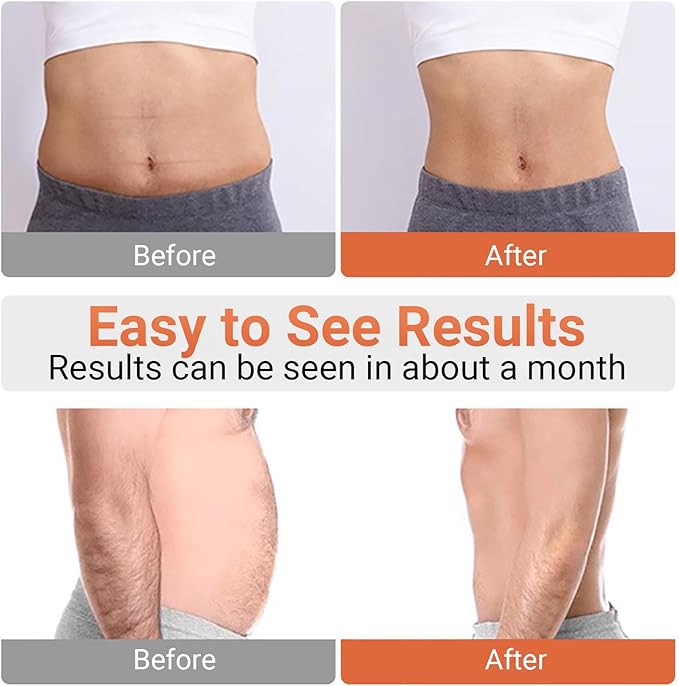 Abs Stimulator, Ab Stimulator Muscle Toner for Gym Office Home