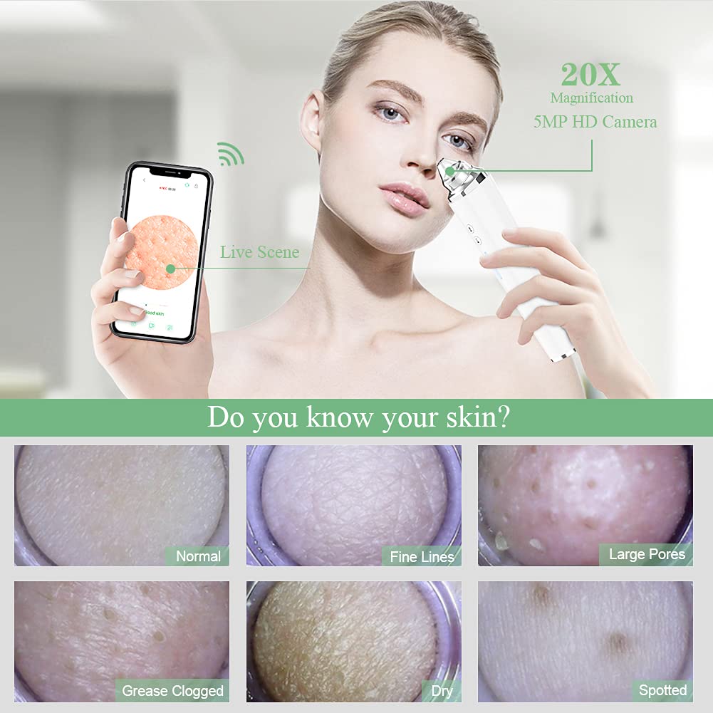 Blackhead Remover Pore Vacuum, 【[FDA Certification] 】 WiFi Visible Facial Pore Cleanser with HD Camera Pimple Acne Comedone Extractor Kit with 6 Suction Heads Electric Blackhead Suction Tool