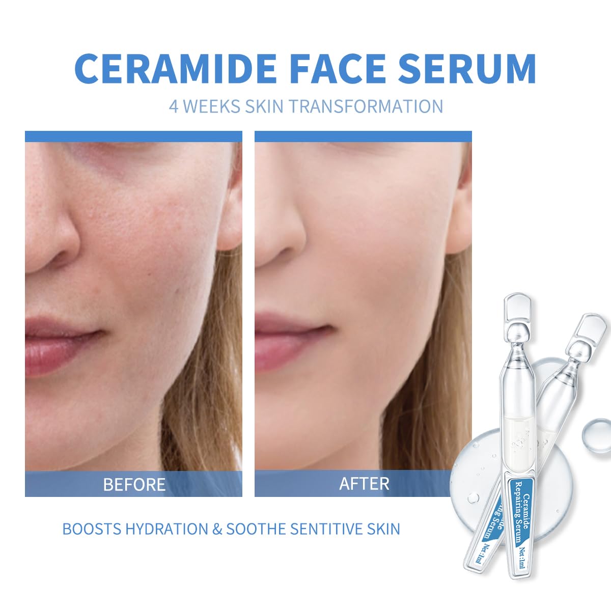 BACHERI Ceramide Ampoule Serum with Hyaluronic Acid, Peptide, Hydrating & Anti Aging, Skin Barrier Repair Face Serum for Dry and Sensitive Skin, 30 Pcs/Box