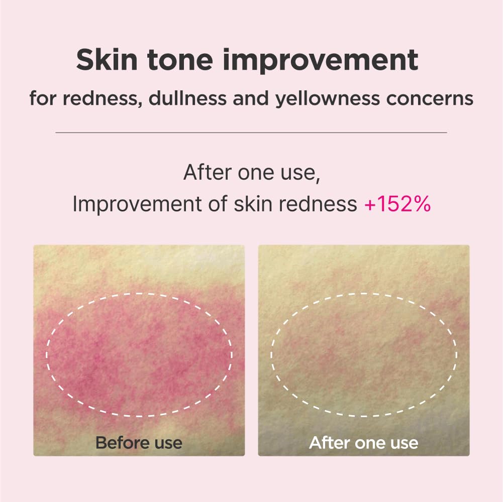 ISOI Blemish Care Up Serum Gift Set, Korean Skin Care Set for Hydration & Radiance – Full Size or 5-Step Travel Kit Options (5-Step Special Kit (1.77 fl. oz))