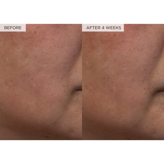 Glow Recipe PHA + BHA Face Toner - Korean Skin Care Pore Minimizer & Gentle Facial Exfoliator for Tightening, Hydrating & Exfoliating - Glycerin, Watermelon & Cactus Water (40ml)