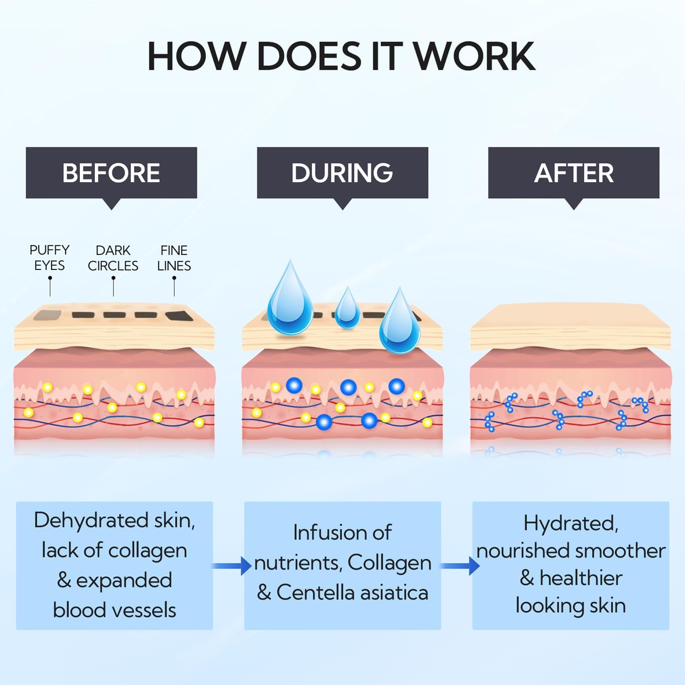 LANBENA Hyaluronic Acid Hydra-Gel Eye Mask Sheet Collagen Eye Patches Skin Care Eye Gel for Moisturizing Remove Dark Circles Eye Bag (30 Pairs)