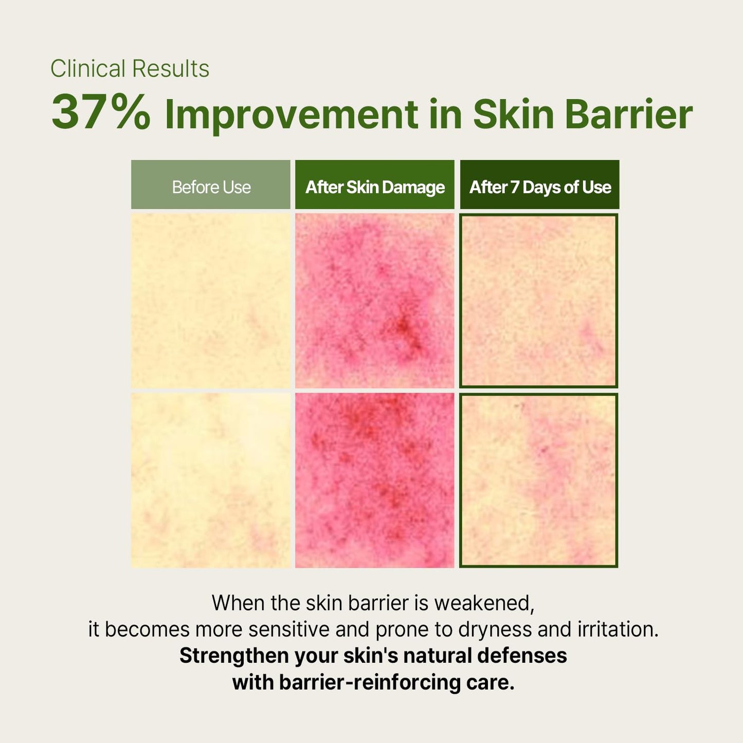 AVCA True Calming Cica Tea Tree Soothing Serum for Sensitive, Balanced Skin (3.38 oz)