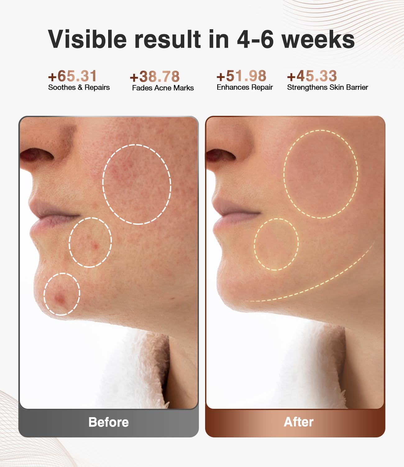 JOVS Red Light Therapy Mask for Face, 328 LEDs Face Mask with Near-Infrared Light, Rechargeable, 4 Modes, Portable Anti-Aging Skin Care Device for Home Use (Brown)