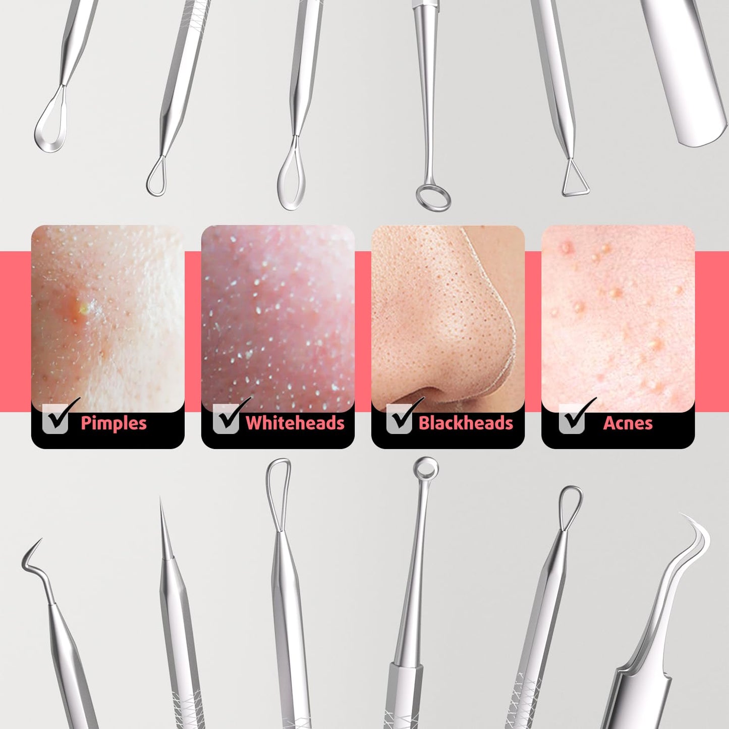 Cbiumpro 6 Pack Blackhead Remover Tools, Pimple Popper Tool Kit, Professional Blackhead Extractor for Zit, Acne, Whitehead, Comedone on Nose - with Case