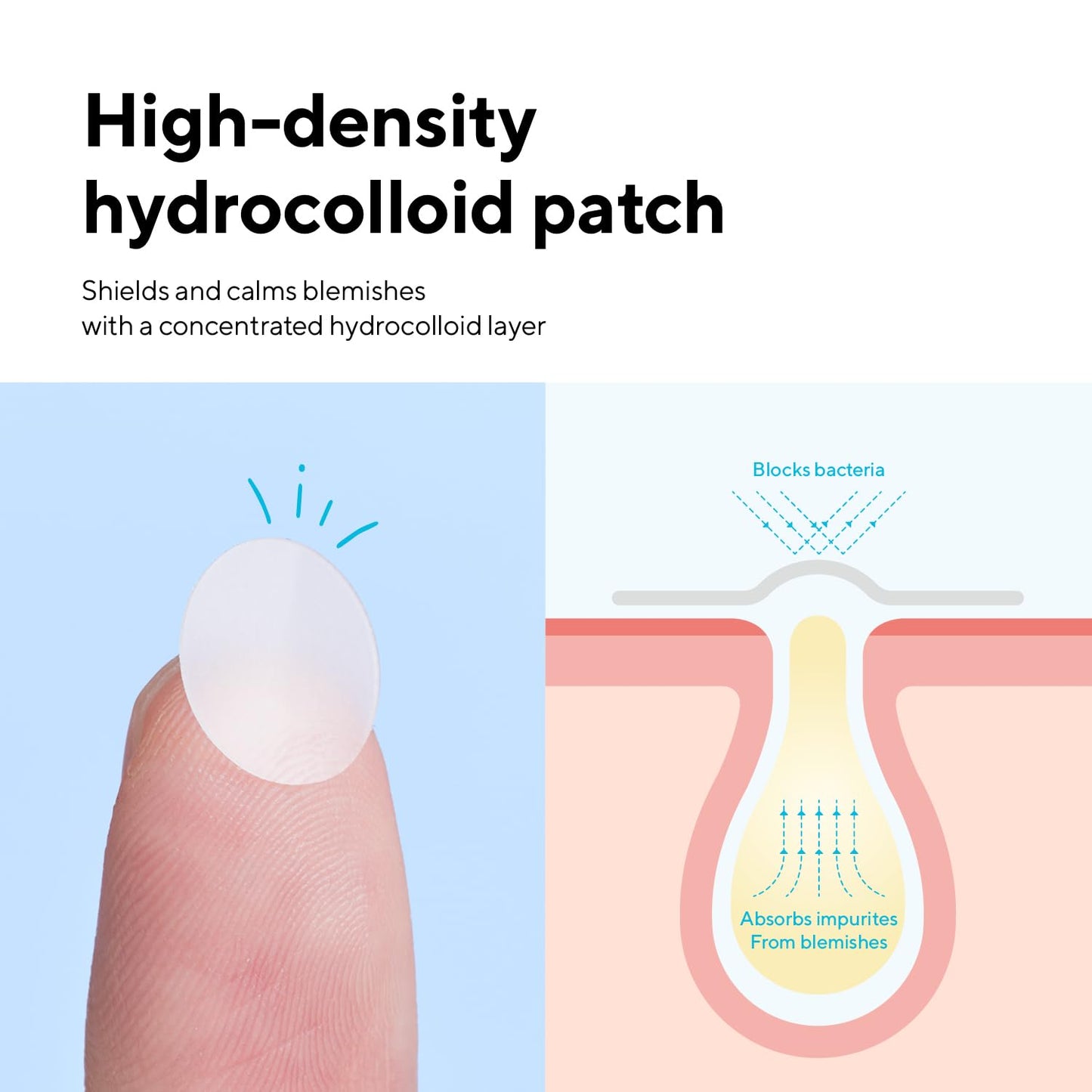 caraseoul Pimple Patches, 2 Size Hydrocolloid Acne Patch for Zits and Blemishes, Bakuchiol & Aloe Vera, Korean Skin Care, Easy to Use – Dermatology Tested