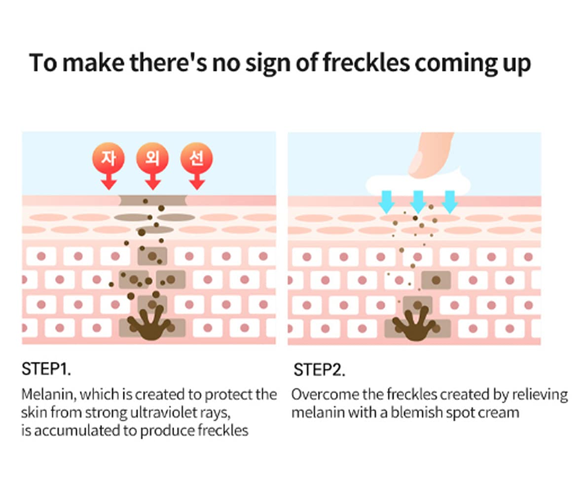 CELLBN Korean Skin Trouble Care Cosmetic Blemish Spot Cream & Patch 30ml+30ml Acne spot Pimple recovery, for skin trouble, Moisturizer