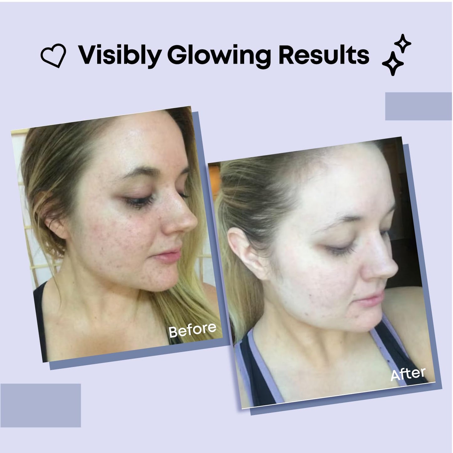 Collagen Face Mask | Hydrating Beauty Skincare Face Mask for Glass Skin, Revitalizing Overnight Collagen Facial Mask for Wrinkles, Selfcare Sheet, Moisturizing Facial Skin Care Product for Women & Men