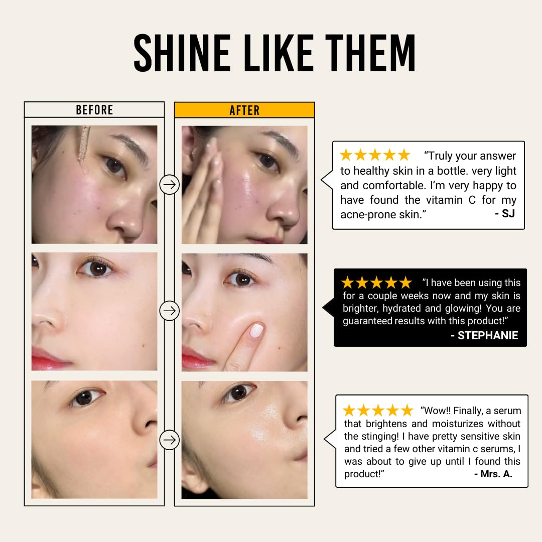 JUMISO All Day Vitamin Serum, Brightening & Balancing Facial Serum 30ml, 1.01 fl oz, 86.14% of Vitamin Tree Extract, 20,000ppm of Niacinamide