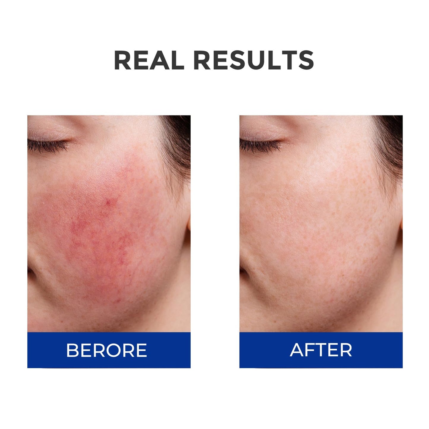 SKINERSE Moisturizing Barrier Serum, 4D Hyaluronic Acid Serum for Face with Vitamin B5 and Ceramides, Anti-Aging Hydrating, Plump and Repair Dry Skin, Daily Skin Care Treatment 1oz