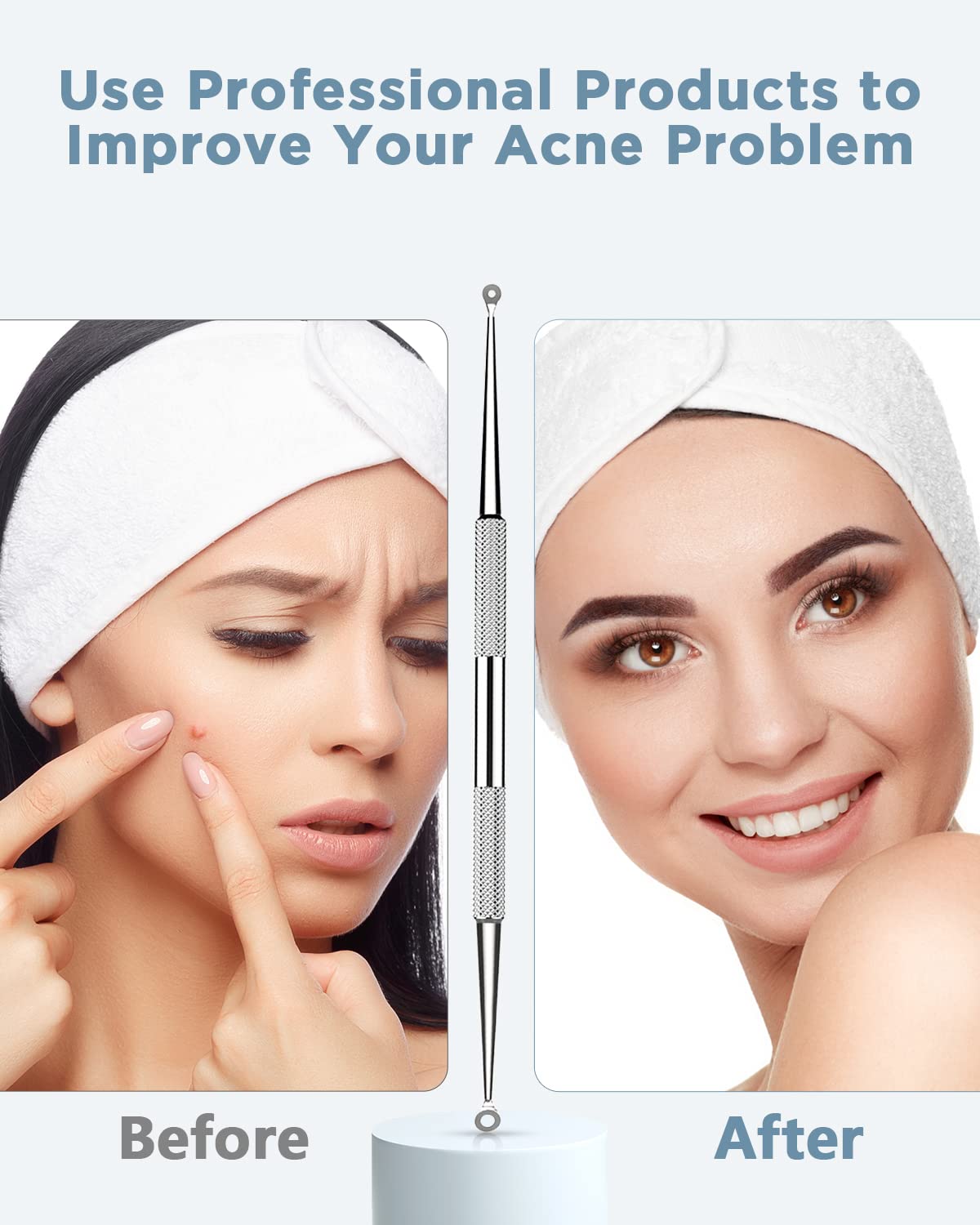 BESTOPE Blackhead Remover Blackhead Removal Pimple Comedone Extractor Tool - Treatment for Blemish Whitehead Popping Zit Removing with Metal Case (Silver)