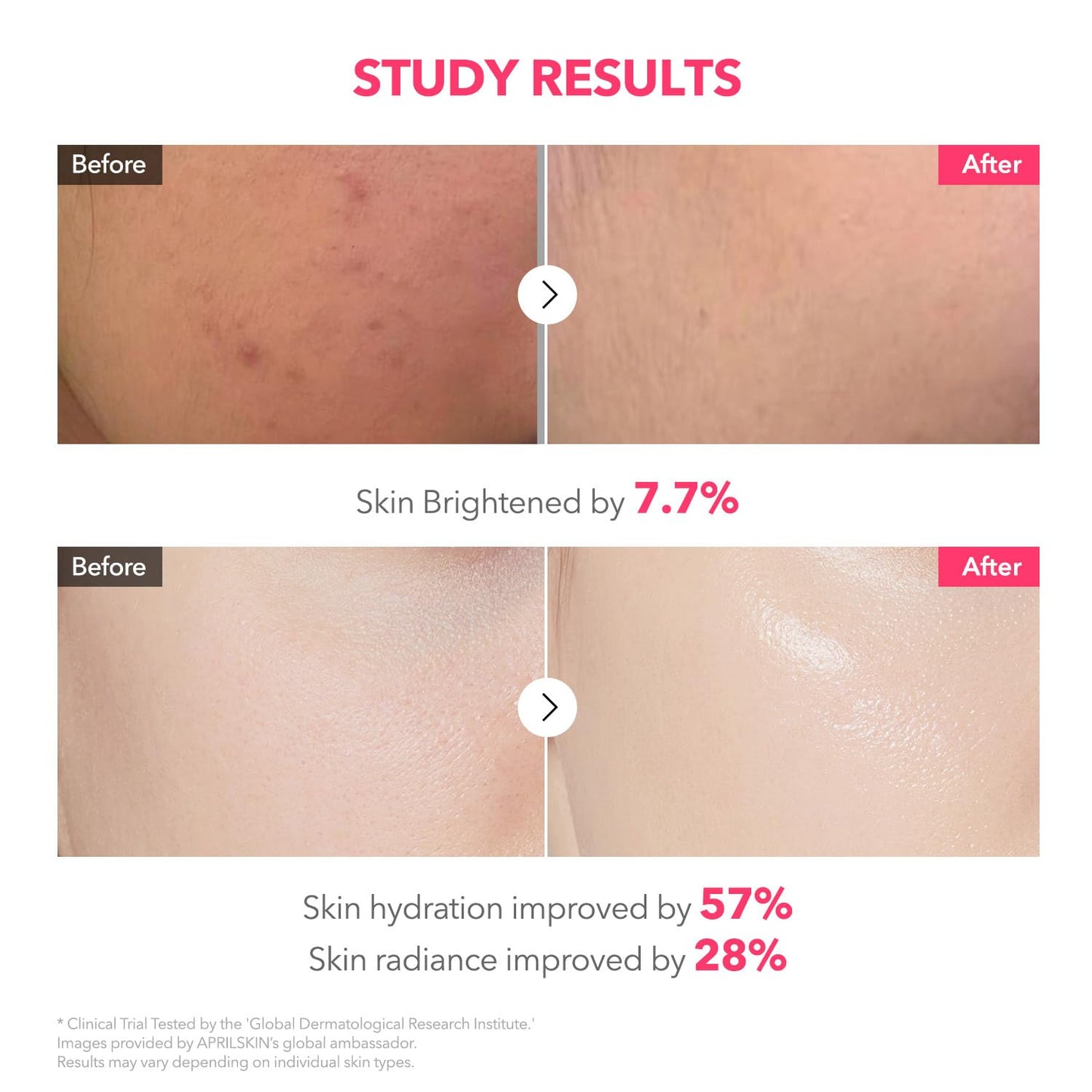 APRILSKIN TXA Pink Capsule Gel Mask | Overnight Face Mask for Glass Glow Skin I 99% High-Purity Tranexamic Acid 3 for uneven skin tone I Elasticity, Hydrating and Firming I Korean Skincare I 30g x 4ea