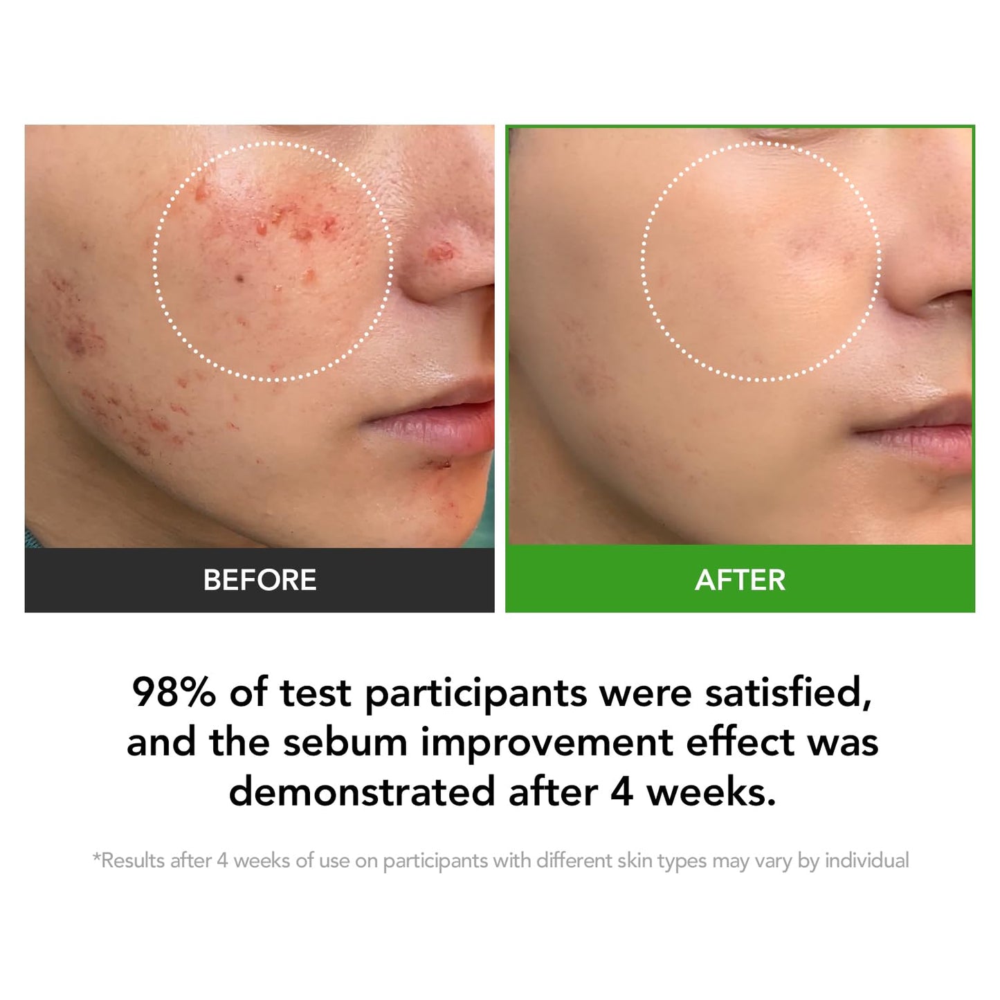 KIOSKIN 31% Reduction in Sebum & 15.5% High-Dose D-Panthenol – Calms Redness, Repairs Skin Barrier & Locks in Hydration – With Heartleaf Extract & Hyaluronic Acid – Korean Skincare Top Barrier Cream