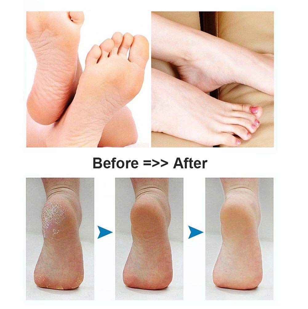 BOMPOW Foot Scrubber Electric Callus Remover Rechargeable Foot File Hard Skin Remover Pedicure Tools Electronic Callus kit for Cracked Heels and Dead Skin with 2 Roller Heads